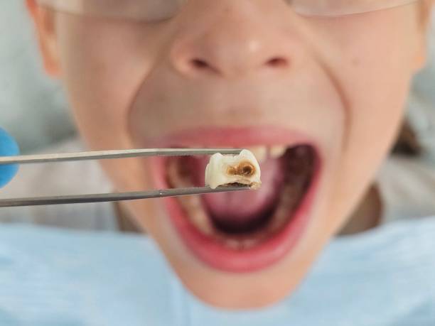 Best Pediatric Emergency Dentist in Moosic, PA